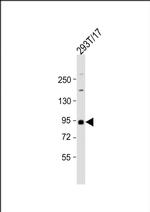 MST1 Antibody in Western Blot (WB)