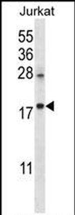 KRTAP25-1 Antibody in Western Blot (WB)
