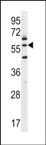 LETM2 Antibody in Western Blot (WB)
