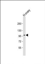ESPNL Antibody in Western Blot (WB)