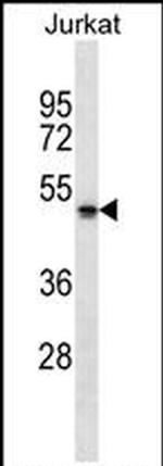 NBPF5P Antibody in Western Blot (WB)
