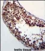 POMT1 Antibody in Immunohistochemistry (IHC)