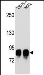 POMT1 Antibody in Western Blot (WB)