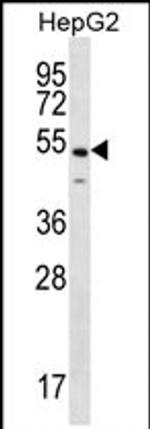 NKAP Antibody in Western Blot (WB)