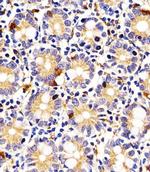 IDO2 Antibody in Immunohistochemistry (IHC)