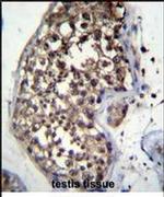 FBXO15 Antibody in Immunohistochemistry (IHC)