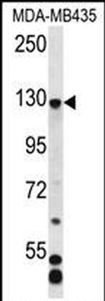 CFAP69 Antibody in Western Blot (WB)