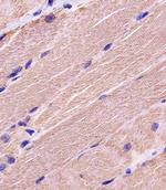 MYBPC3 Polyclonal Antibody