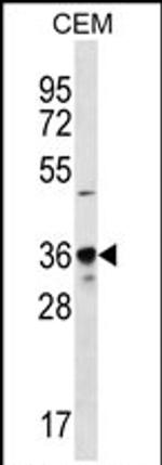 PDC Antibody in Western Blot (WB)