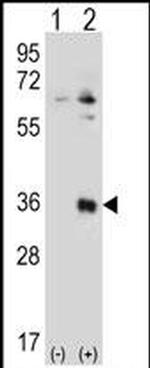 TSSK6 Antibody in Western Blot (WB)