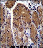 TSSK6 Antibody in Immunohistochemistry (IHC)