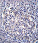 SESN3 Antibody in Immunohistochemistry (IHC)