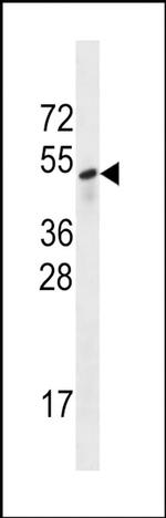 SESN3 Antibody in Western Blot (WB)