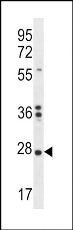 NKAIN1 Antibody in Western Blot (WB)