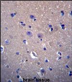 DNAJB6 Antibody in Immunohistochemistry (IHC)
