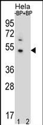 DNAJB6 Antibody in Western Blot (WB)