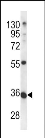 METTL11B Antibody in Western Blot (WB)