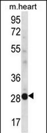 NCCRP1 Polyclonal Antibody