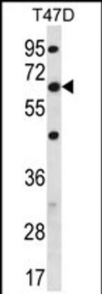 FAM83D Antibody in Western Blot (WB)
