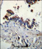 Ficolin 3 Polyclonal Antibody