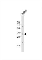Ficolin 3 Antibody in Western Blot (WB)