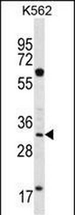 Ficolin 3 Antibody in Western Blot (WB)