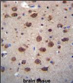 PNKD Antibody in Immunohistochemistry (IHC)