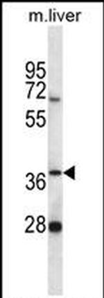 PNKD Antibody in Western Blot (WB)