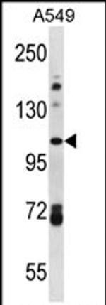 FAM13B Antibody in Western Blot (WB)