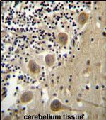 BEND6 Antibody in Immunohistochemistry (IHC)