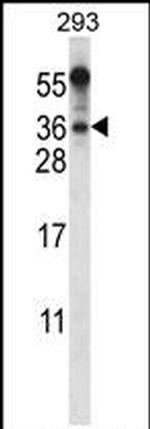 BEND6 Antibody in Western Blot (WB)