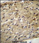 ABCD2 Antibody in Immunohistochemistry (IHC)