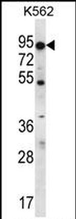 ABCD2 Antibody in Western Blot (WB)