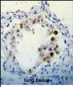 CDKN2B Antibody in Immunohistochemistry (IHC)