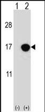 CDKN2B Antibody in Western Blot (WB)