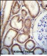 Tetranectin Antibody in Immunohistochemistry (IHC)