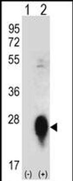 Tetranectin Antibody in Western Blot (WB)