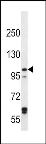IREB2 Antibody in Western Blot (WB)