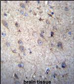 GSTM5 Antibody in Immunohistochemistry (IHC)