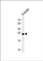 GSTM5 Antibody in Western Blot (WB)