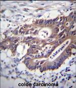 Cytokeratin 12 Polyclonal Antibody