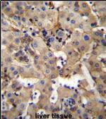 SGPL1 Antibody in Immunohistochemistry (IHC)