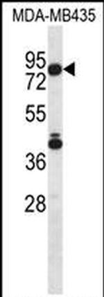 SGPL1 Antibody in Western Blot (WB)