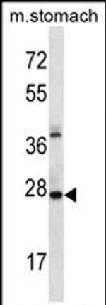 ALKBH4 Antibody in Western Blot (WB)