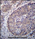 PNLIPRP3 Antibody in Immunohistochemistry (IHC)