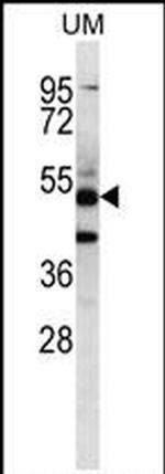 PNLIPRP3 Antibody in Western Blot (WB)