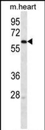 LINGO4 Antibody in Western Blot (WB)