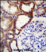 STARD4 Antibody in Immunohistochemistry (IHC)