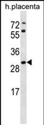 STARD4 Antibody in Western Blot (WB)