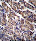 ABRA Antibody in Immunohistochemistry (IHC)